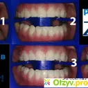 Zoom 4 отбеливание отзывы - отзыв